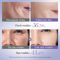 Bioaqua - Retinol Skin Set (Original)