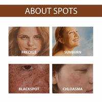 Anti Freckle Serum (Original)